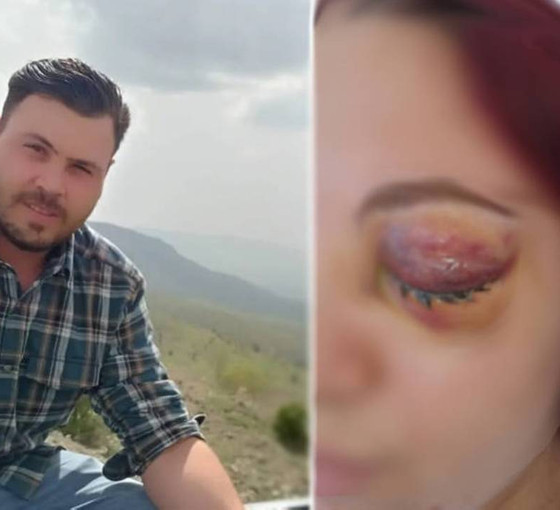 Eski sevgilisini kaçırıp saldıran erkek, ikinci kez gözaltına alınıp tutuklandı