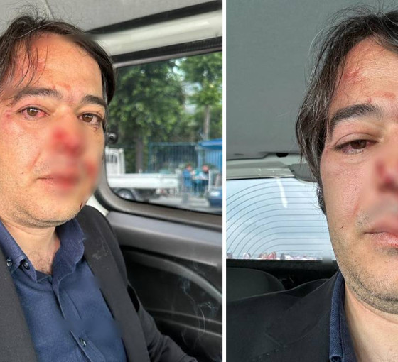 İBB İmar Müdürü Ramazan Gülten'e saldıran sanık hakkında 10 yıl 9 ay hapis talebi