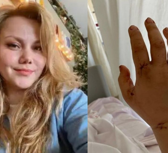 Evli olduğu erkek tarafından bıçaklanan Merve Veziroğlu'ndan iyi haber: Mucizevi şekilde hayatta kaldım