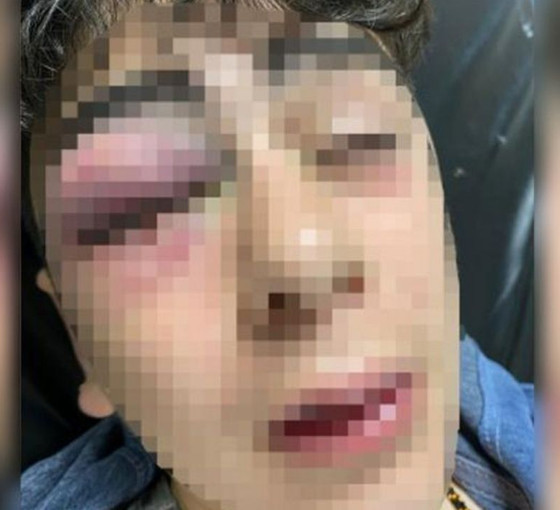 Lice’de çocuğa işkence davasının ilk duruşması yarın