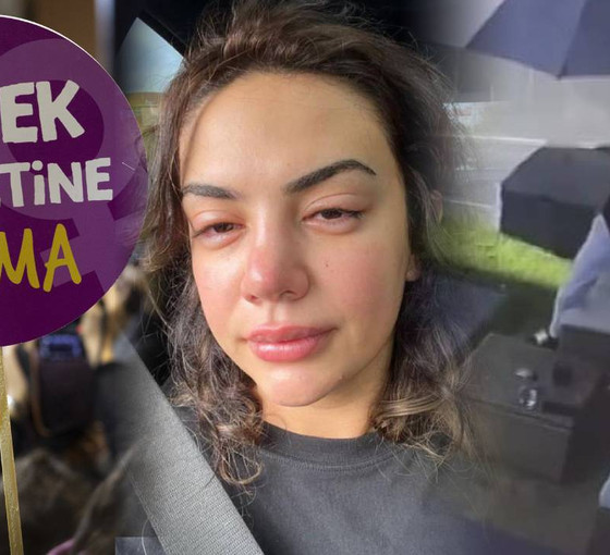 Şarkıcı Ece Ronay yardım istedi: Mehmet Bilir tarafından şiddete maruz bırakıldım