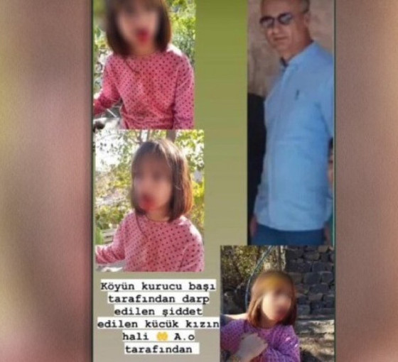 Şırnak'ta 10 yaşındaki çocuğa korucubaşı şiddeti: 'Münferit bir olay değil'