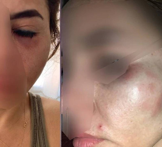 Kadına şiddet, tehdit ve taciz hakkında 'kovuşturmaya yer yok' kararı