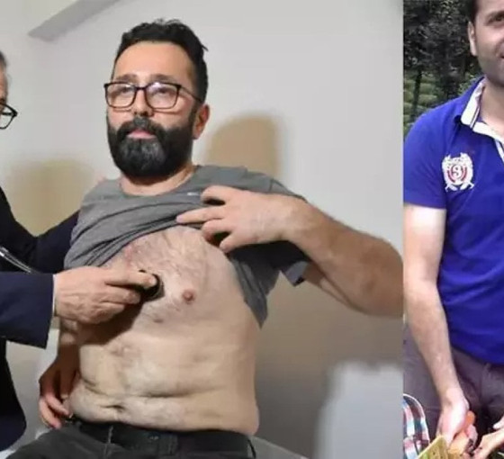 Türkiye'de ilk: Nakil kalbe 25 yıl sonra baypas ameliyatı yapıldı