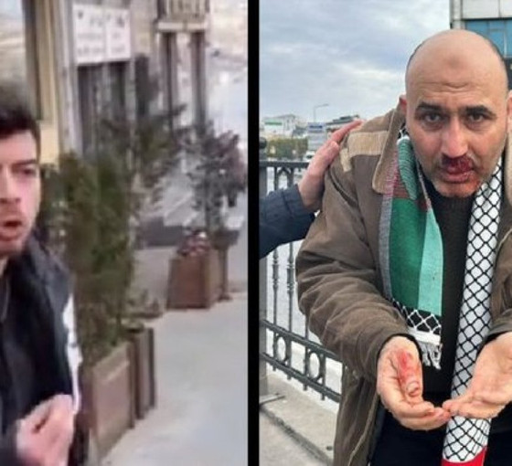 Filistin mitingi sonrası 'tevhid bayrağı' kavgası: Yumruk vurana tokat atan kişi serbest