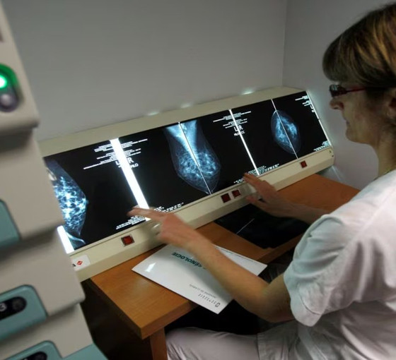 DSÖ'nün kanser raporu: Vakalar 2050'ye kadar yüzde 77 oranında artacak