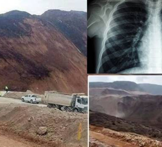 Türk Toraks Derneği endişeleri haklı çıkardı: Siyanür solunum yoluyla da zehirler