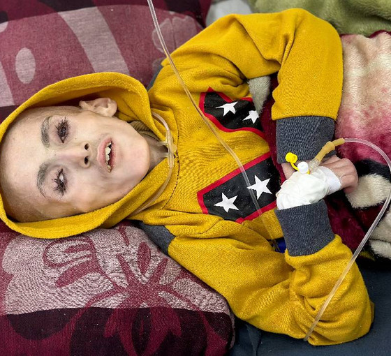Reuters'de Gazze'deki bir deri bir kemik çocukların görüntüleri, DSÖ'den 'Filistinli çocuklar açlıktan ölüyor' uyarısı