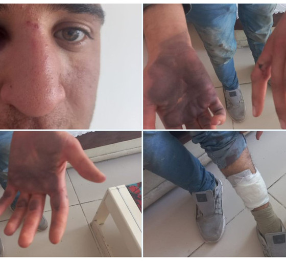 DEM Parti Gençlik Meclisi üyesine gözaltında işkence