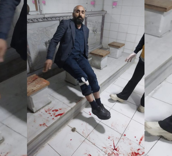 Başakşehir’de DEM Parti sandık görevlisine silahlı saldırı: Metin Çimendağ ayağından yaralandı