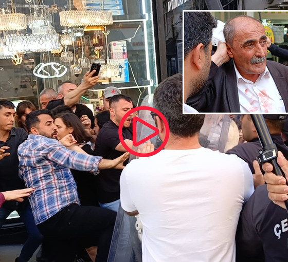 Adana'da polis DEM Partililere plastik mermi ve dubalarla saldırdı, İl Eşbaşkanı Aydemir başından yaralandı