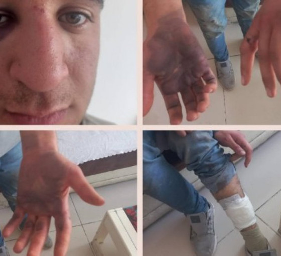 DEM Partili Gezici hakkında iddianame: 'Penseli işkence' beyanlarına yer verilmedi