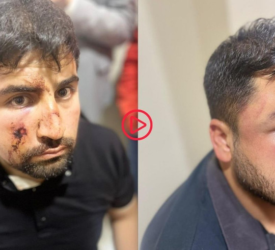 AKP’li belediye İmrahor mahallesinde yıkım kararı aldı, mahalleli ters kelepçeyle gözaltına alındı