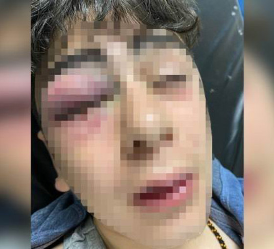 Lice’de çocuğa işkence davasında polislere sekizer yıl ceza
