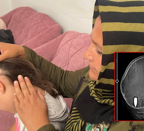 Antep'te 9 yaşındaki çocuğun kafasındaki mermi çekirdeği bir yıl sonra fark edildi: 'İhmali bulunanlar hesap versin'