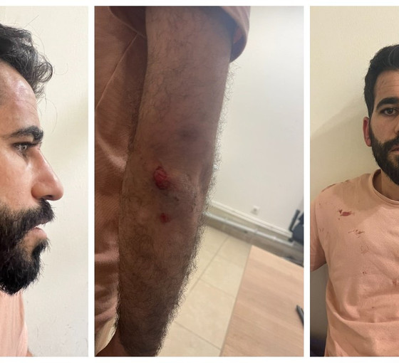 Avukat Kandemir: İstanbul Emniyet Müdürlüğü'nde polisler tarafından öldüresiye dövüldük