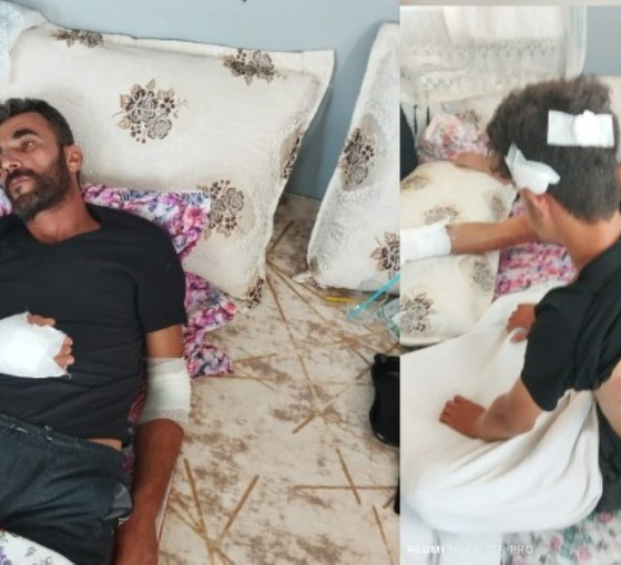 DEM Parti'den Muğla'da Kürt işçilere yapılan ırkçı saldırıya tepki: Irkçı saldırganlar iktidar politikalarından güç alıyor