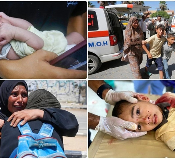 Gazze'deki yabancı doktorlar, İsrail'in şarapnel etkili bombalarının çocuklara etkisini anlattı