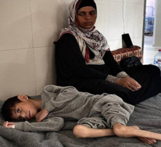 Filistinli doktor Hur: Gazze'deki hastaneler yetersiz beslenme vakalarıyla dolu