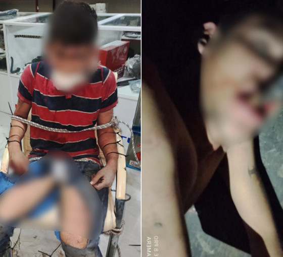 Hakkını istediği için işkence gören Urfalı işçi adalet arıyor: 'Hayatım altüst oldu'