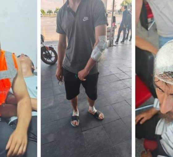 Amedspor forması giyen işçi tutuklandı: Saldırıya uğradı, vuruldu, gözaltına alındı