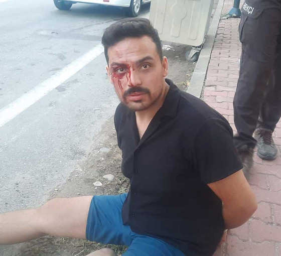 'Ölmek istemiyorum' diye video paylaşan kadın, evli olduğu erkek tarafından tüfekle yaralandı