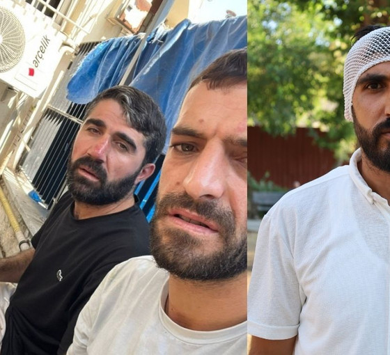 Balıkesir'de ırkçı saldırıya uğrayan işçi anlattı: Organize bir saldırıydı