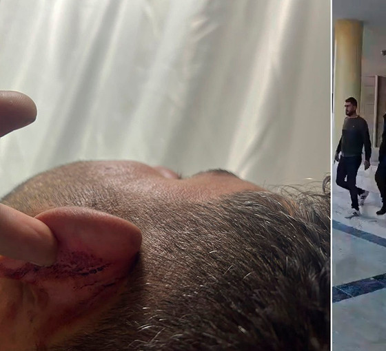 Urfa'da şiddet gören işçi tutuklandı: 'Tutanaklar avukatlar olmadan, zorla imzalatılmış'