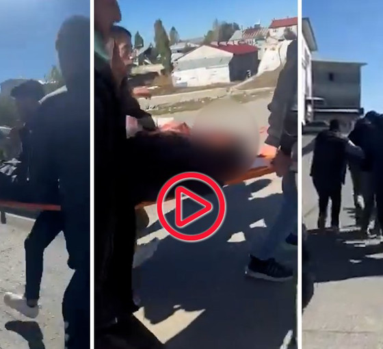 Ağrı'da hastane yakınlarında kaza geçiren Aslan kan kaybından öldü: 'Ambulans yok diye sedyeyle taşındı'