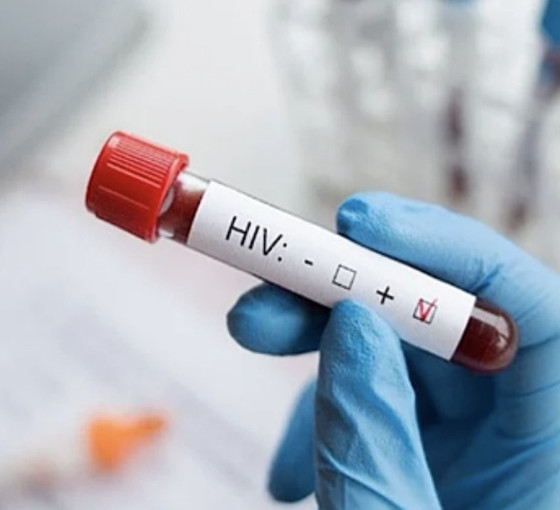 İzmir'de 13 yaşındaki çocuk AIDS nedeniyle öldü