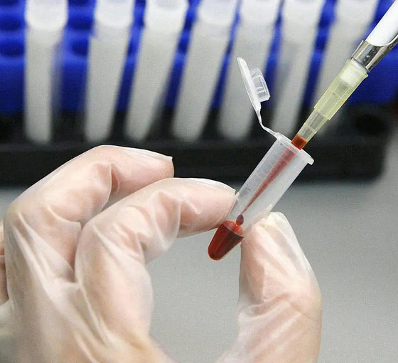 İl Sağlık Müdürlüğü'nden AIDS'ten ölen çocuğa dair açıklama: İstismar bulgusuna rastlanmadı