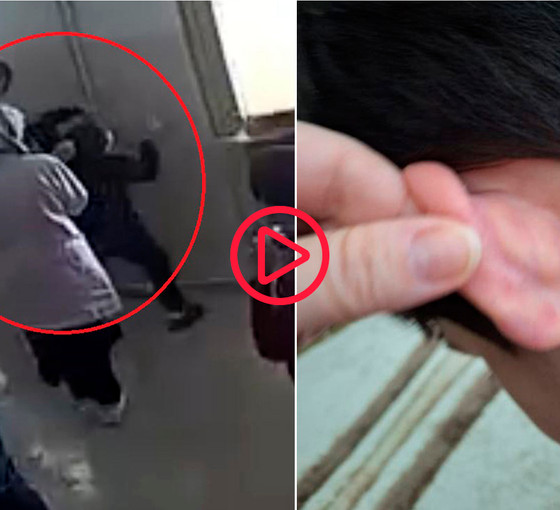Otizmli çocuğa özel eğitim kurumunda darp