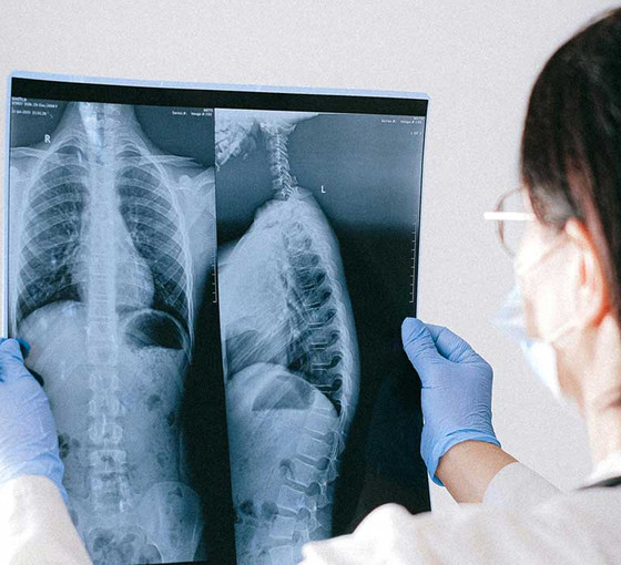 'Solunum yolu enfeksiyonları nedeniyle yoğun bakımlarda artış var'