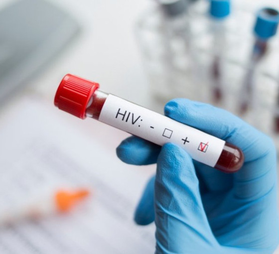 Evlenmeden önce HIV pozitif olduğunu eşinden saklayan sanığa dava