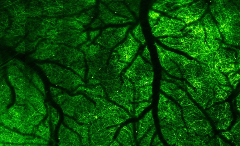 Beyin sinyalleri yeni bir mikroskopla gözlemlenebilecek