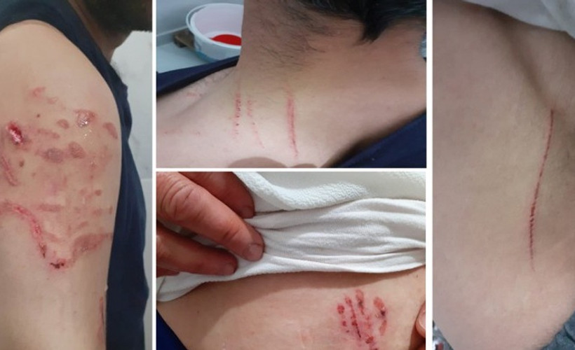 Diyarbakır'da polislerden, Yılmaz çiftine köpekli işkence