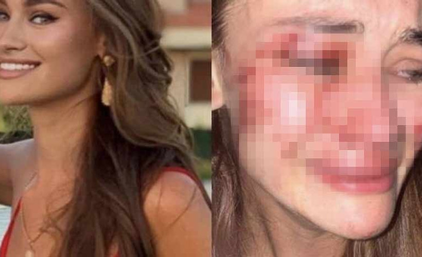 Ünlü model İzmir'de güvenlik görevlilerin saldırısına uğradı