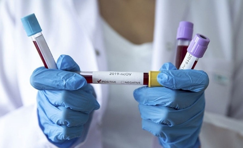 Çalışanın Coronavirus testi pozitif çıktı, sosyal tesis izolasyona alındı