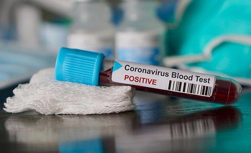 Türkiye'nin Coronavirus tablosu: Yeni vaka sayısı bin 700'ü geçti