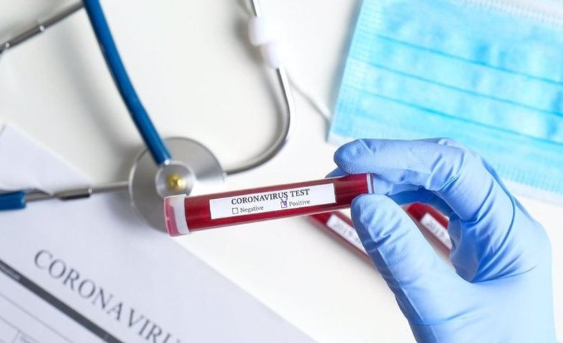 'Covid-19 testleri, vaka sayısını az göstermek için sınırlı tutuluyor'