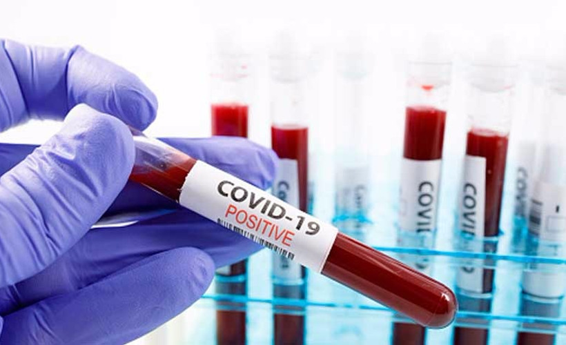 Araştırma: Coronavirus insan derisinde 9 saat kalabiliyor