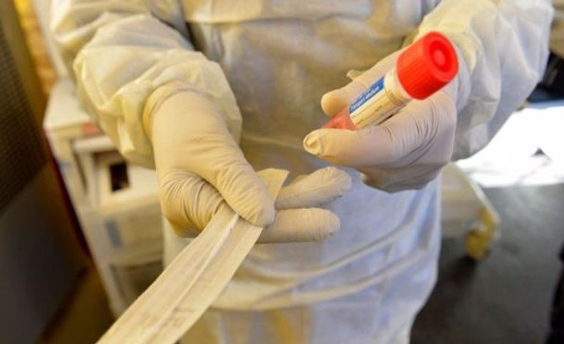 'Corona testleri piyasanın insafına bırakıldı'