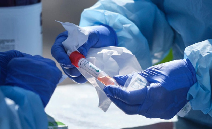 Coronavirus tablosu: 193 vefat, 31.923 pozitif vaka