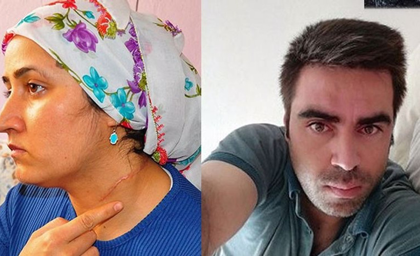 Eşi tarafından boğazı kesilen Esra Oymak: Korkuyorum, sokağa bile çıkamıyorum