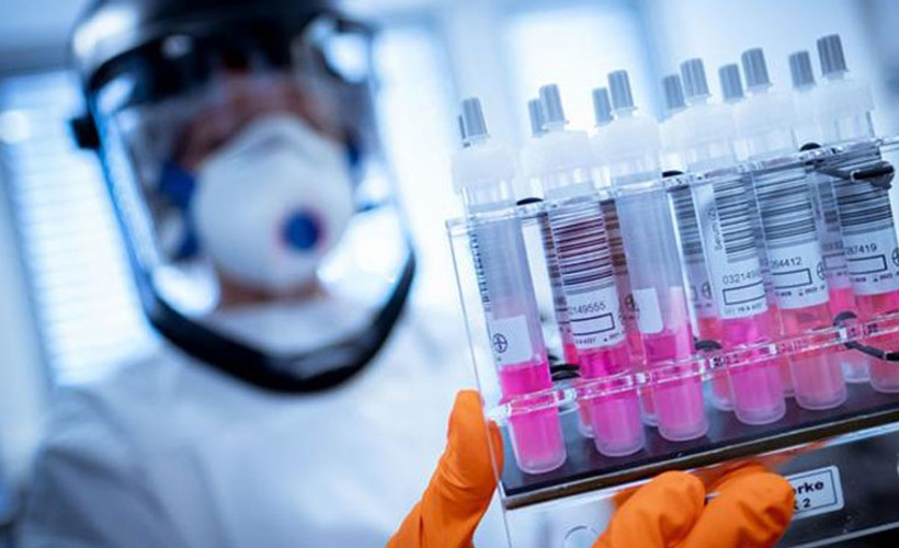 Coronavirus tablosu: 86 kişi yaşamını yitirdi