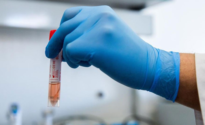 Coronavirus tablosu: 30 bin 21 yeni Covid-19 vakası tespit edildi