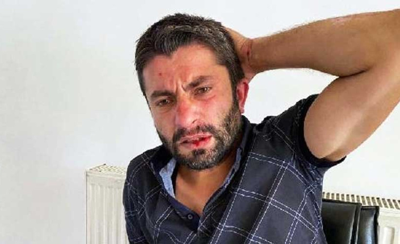 Haber takibindeki muhabire saldırı