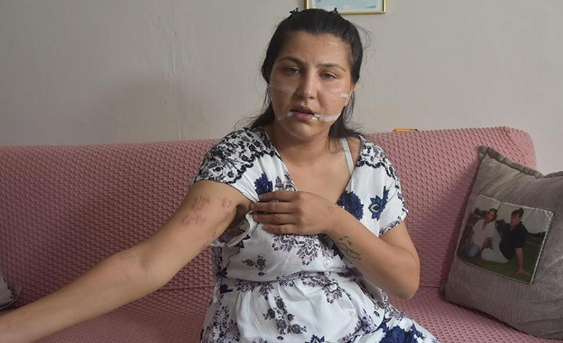 1 yaşındaki oğlunun yanında 104 yerinden bıçaklandı