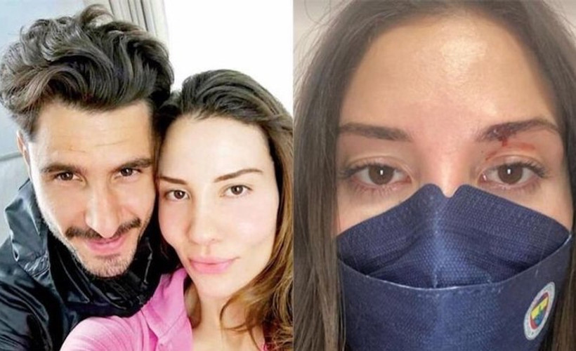 Futbolcu Özer Hurmacı'dan eşine şiddet: Sen bir canavarsın, artık yeter
