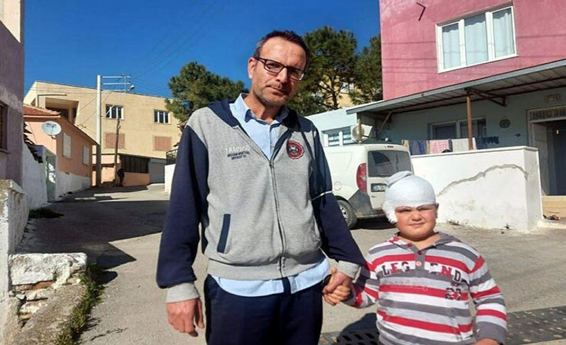 Altı yaşındaki çocuk sevmek istediği pitbullun saldırısına uğradı
